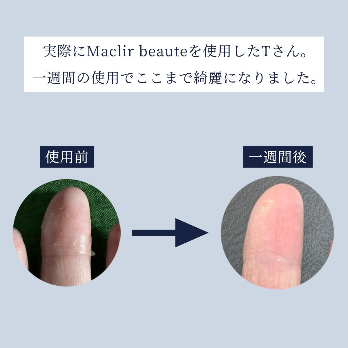 Maclir beauteマクリル・ボーテ　お試し版お得セット　2970120000038